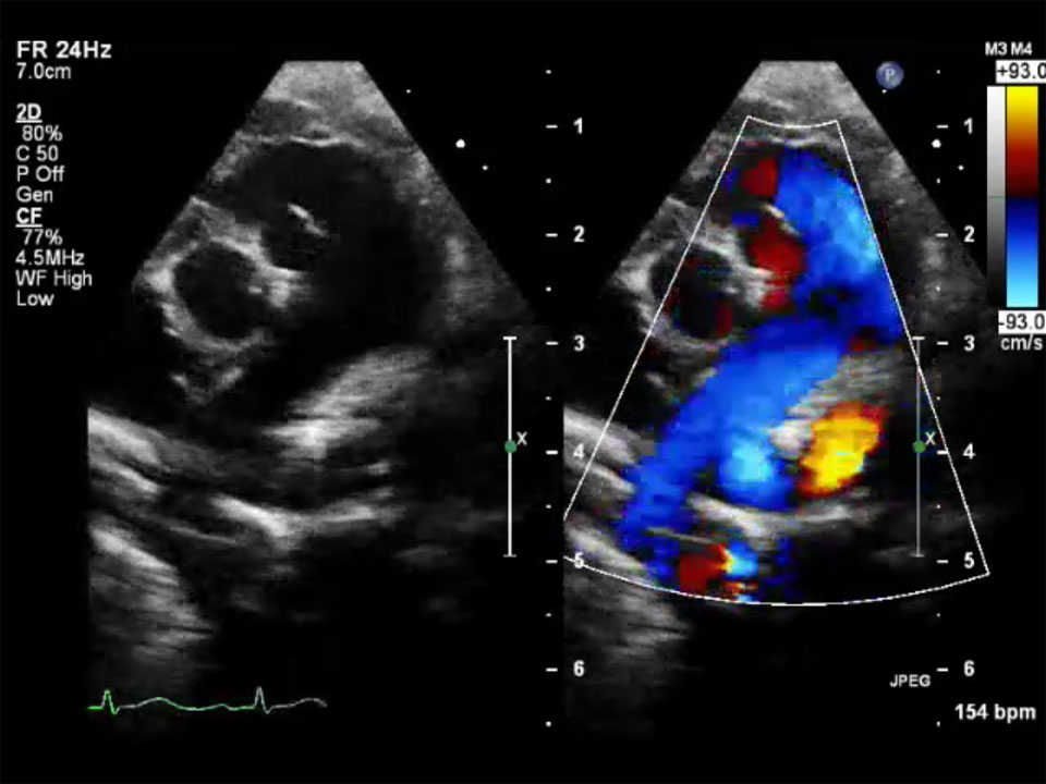Sample pediatric echocardiography image