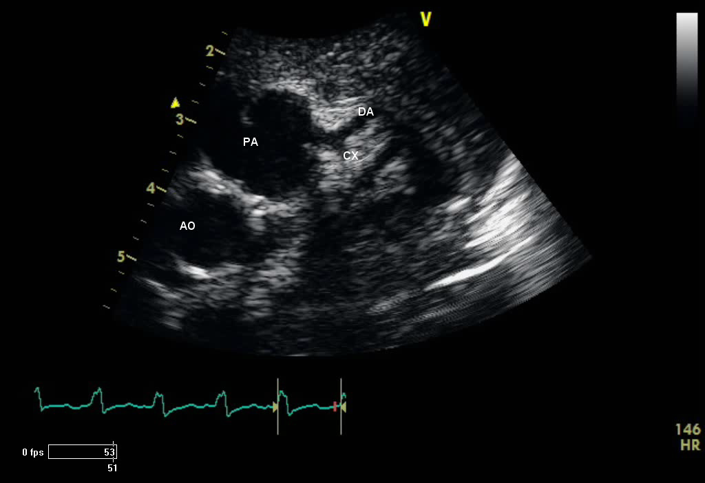 shop examination review for ultrasound abdomen and obstetrics gynecology