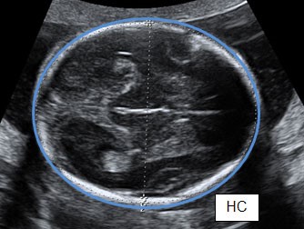 Fetal Biometrics Pediatric Echocardiography Fetal Biometrics Pediatric Echocardiography